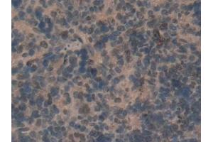 Immunohistochemistry (IHC) image for anti-CD2-Associated Protein (Cd2ap) (AA 368-623) antibody (ABIN7439519)