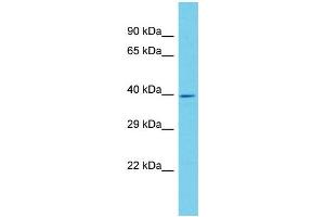 Host: Rabbit Target Name: ANKRD16 Sample Type: Hela Whole cell lysates Antibody Dilution: 1. (ANKRD16 antibody  (N-Term))