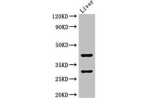 Western Blot Positive WB detected in: Mouse liver tissue All lanes: TIMD4 antibody at 2 μg/mL Secondary Goat polyclonal to rabbit IgG at 1/50000 dilution Predicted band size: 42, 39 kDa Observed band size: 42, 30 kDa (TIMD4 antibody  (AA 134-301))