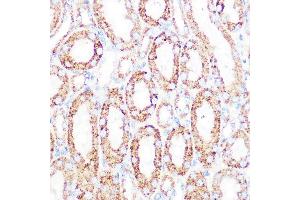 Immunohistochemistry of paraffin-embedded mouse kidney using DLDH/DLD Rabbit mAb (ABIN7266766) at dilution of 1:100 (40x lens).