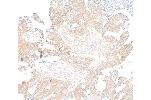 Immunohistochemistry (IHC) image for anti-RPTOR Independent Companion of mTOR, Complex 2 (RICTOR) (C-Term) antibody (ABIN7795814)