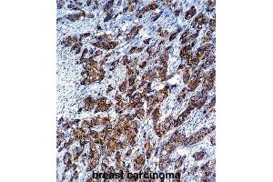 Immunohistochemistry (IHC) image for anti-Galectin 3 (LGALS3) antibody (ABIN2995387) (Galectin 3 antibody)