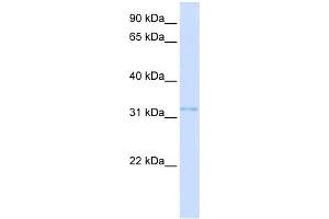 WB Suggested Anti-VDAC2 Antibody Titration:  0. (VDAC2 antibody  (N-Term))