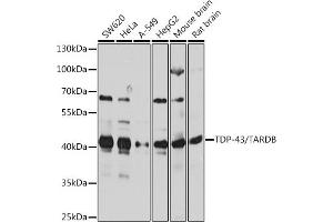 Western blot analysis of extracts of various cell lines, using TDP-43/TARDB antibody  at 1:1000 dilution. (TARDBP antibody  (AA 1-100))