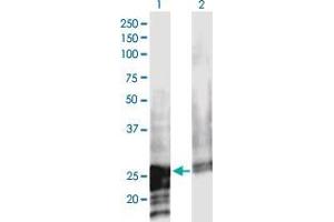 Western Blot analysis of NOL3 expression in transfected 293T cell line by NOL3 monoclonal antibody (M02), clone 3A9. (NOL3 antibody  (AA 1-208))