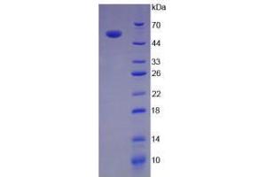 Figure. (Interleukin 35 Protein (IL35) (AA 21-229, AA 23-219) (His tag))