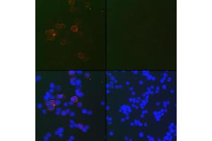 Immunofluorescence analysis of 293T-N and 293T cells using SARS-CoV-2 Nucleoprotein antibody (ABIN7269048) at dilution of 1:100. (Nucleoprotein antibody)