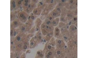 Immunohistochemistry (IHC) image for anti-Interferon Regulatory Factor 3 (IRF3) (AA 1-406) antibody (ABIN1868750)