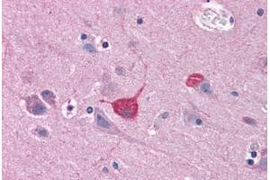 Human Brain, Cortex: Formalin-Fixed, Paraffin-Embedded (FFPE) (BOK antibody  (C-Term))