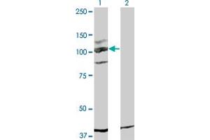 Western Blot analysis of KIT expression in transfected 293T cell line by KIT monoclonal antibody (M05), clone 5F6. (KIT antibody  (AA 41-140))