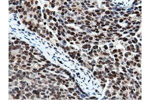 Immunohistochemical staining of paraffin-embedded Human Kidney tissue using anti-NT5DC1 mouse monoclonal antibody. (NT5DC1 antibody)