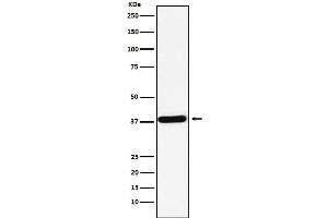 Western Blotting (WB) image for anti-V-Crk Sarcoma Virus CT10 Oncogene Homolog (Avian) (CRK) antibody (ABIN7606804)