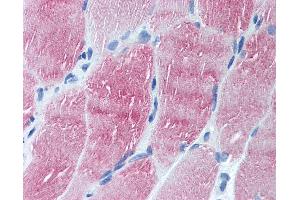 Anti-ARL6 antibody IHC of human skeletal muscle. (ARL6 antibody  (N-Term))