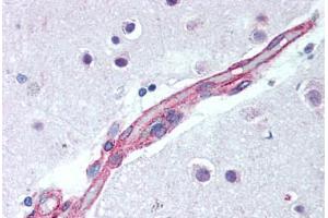 Brain, cortex, capillary (JNK2 antibody  (AA 373-389))