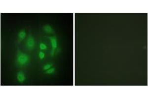 Immunofluorescence analysis of HepG2 cells, using hnRNP Q Antibody.