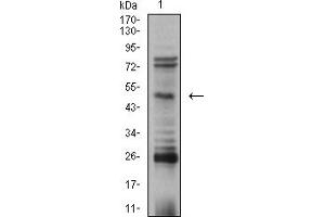 Western Blotting (WB) image for anti-Transcription Factor AP-2 beta (Activating Enhancer Binding Protein 2 Beta) (TFAP2B) (AA 84-193) antibody (ABIN5611289)