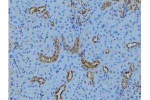 ABIN6279279 at 1/100 staining Mouse kidney tissue by IHC-P. (CEP72 antibody)