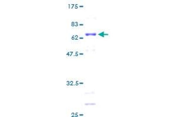 MAGEA1 Protein (AA 1-309) (GST tag)