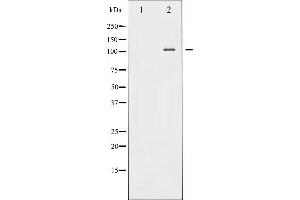 Western blot analysis of NF- kappaB p100/p52 phosphorylation expression in TNF-α treated MDA-MB-435 whole cell lysates,The lane on the left is treated with the antigen-specific peptide. (NFKB2 antibody  (pSer870))