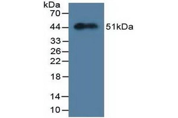 MYL3/CMLC1 antibody  (AA 8-199)