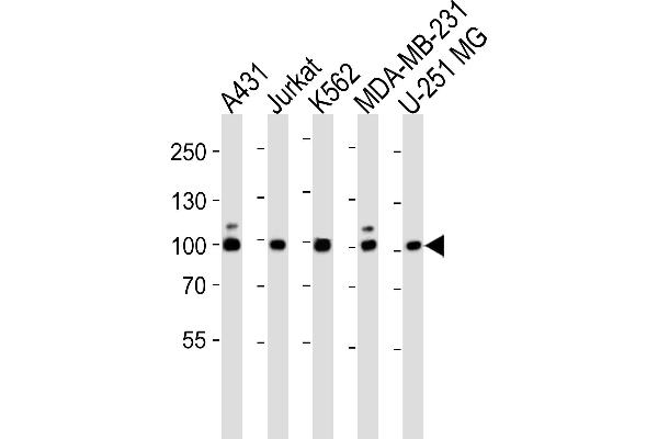 ZNF175 antibody  (N-Term)