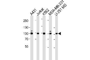 Western blot analysis of lysates from A431, Jurkat, K562, MDA-MB-231, U-251 MG cell line (from left to right), using ZN Antibody (N-term) (ABIN1944760 and ABIN2838552).