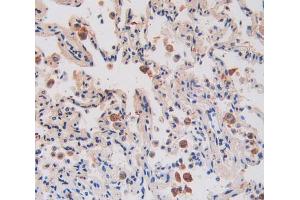 IHC-P analysis of lung tissue, with DAB staining. (IL17RA antibody  (AA 377-534))