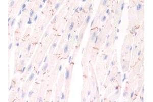 DAB staining on IHC-P; Samples: Mouse Cardiac Muscle Tissue (PIM1 antibody  (AA 122-261))