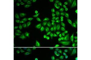 Immunofluorescence analysis of MCF-7 cells using PTPN1 Polyclonal Antibody (PTPN1 antibody)