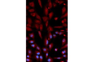 Immunofluorescence (IF) image for anti-WNT Inhibitory Factor 1 (WIF1) antibody (ABIN1876574)