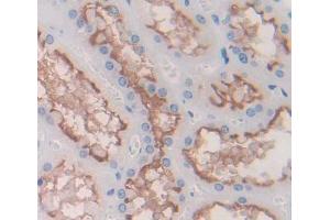 Used in DAB staining on fromalin fixed paraffin- embedded kidney tissue
