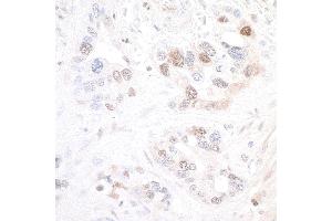 Immunohistochemistry (IHC) image for anti-Nicotinamide phosphoribosyltransferase (NAMPT) (AA 400-450) antibody (ABIN7454014) (Recombinant NAMPT antibody  (AA 400-450))