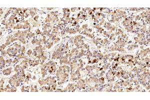 Detection of PRL in Porcine Pituitary Tissue using Polyclonal Antibody to Prolactin (PRL) (Prolactin antibody  (AA 31-229))