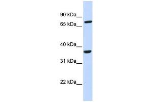 CCRL2 antibody used at 1 ug/ml to detect target protein.