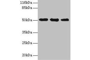 Western blot All lanes: KRT38 antibody at 2 μg/mL Lane 1: MCF-7 whole cell lysate Lane 2: Hela whole cell lysate Lane 3: HepG2 whole cell lysate Secondary Goat polyclonal to rabbit IgG at 1/10000 dilution Predicted band size: 51 kDa Observed band size: 51 kDa (KRT38 antibody  (AA 2-456))