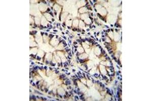 Formalin fixed and paraffin embedded human rectum tissue reacted with ECT2L Antibody (C-term) followed by peroxidase conjugation of the secondary antibody and DAB staining. (ECT2L antibody  (C-Term))