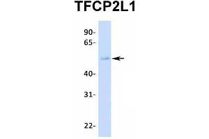 Host:  Rabbit  Target Name:  TFCP2L1  Sample Type:  Human Fetal Lung  Antibody Dilution:  1.