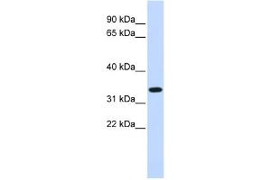 WB Suggested Anti-TRIM14 Antibody Titration:  0. (TRIM14 antibody  (Middle Region))