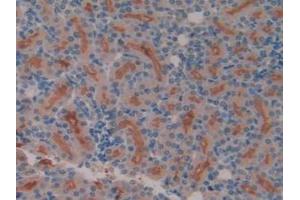 IHC-P analysis of Rat Kidney Tissue, with DAB staining. (Meprin B antibody  (AA 433-679))