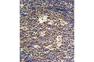 IL4 Antibody (C-term) (ABIN651434 and ABIN2840238) IHC analysis in formalin fixed and paraffin embedded tonsil followed by peroxidase conjugation of the secondary antibody and DAB staining. (IL-4 antibody  (C-Term))