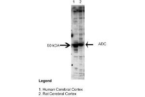Sample Type: Human and Rat Cerebral CortexPrimary Dilution: 1:3000 (ADC antibody  (Middle Region))