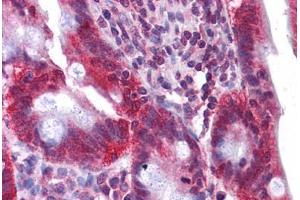 Human Small Intestine: Formalin-Fixed, Paraffin-Embedded (FFPE) (HNF4A antibody  (C-Term))
