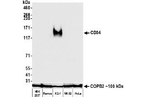 Western Blotting (WB) image for anti-CD34 (CD34) (AA 33-290) antibody (ABIN7453960) (Recombinant CD34 antibody  (AA 33-290))