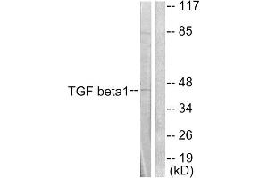 Western blot analysis of extracts from HepG2 cells, using TGF beta 1 antibody (ABIN5976515).