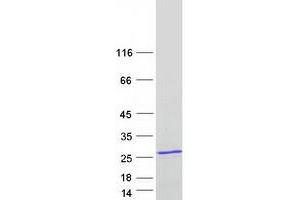 Validation with Western Blot (TNNI2 Protein (Transcript Variant 2) (Myc-DYKDDDDK Tag))