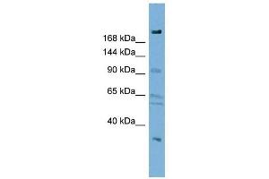 DIP2A antibody used at 1 ug/ml to detect target protein. (DIP2A antibody)