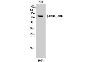Western Blotting (WB) image for anti-serine/threonine Kinase 11 (STK11) (pThr189) antibody (ABIN3173021) (LKB1 antibody  (pThr189))