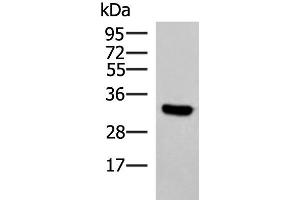 Western blot analysis of Hela cell lysate using KCTD7 Polyclonal Antibody at dilution of 1:1200 (KCTD7 antibody)