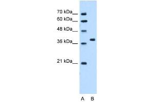 Western Blot showing RUNDC2A antibody used at a concentration of 5. (SNX29 antibody  (N-Term))
