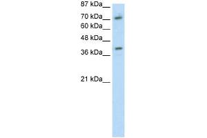 WB Suggested Anti-ZNF282 Antibody Titration: 1. (ZNF282 antibody  (C-Term))